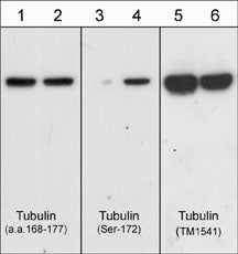 1 - Anti-β-Tubulin Antibody AN2001