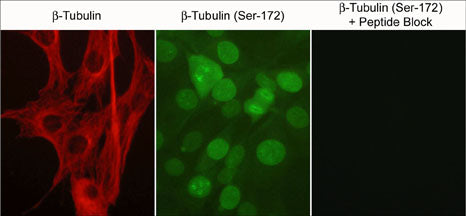 2 - Anti-β-Tubulin Antibody AN2001