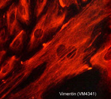 2 - Anti-Vimentin Antibody AN2016