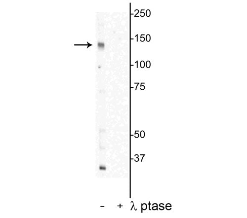 1 - Anti-DENND3 (Thr450) Antibody AN1357