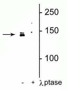 1 - Anti-DENND3 (Ser554) Antibody AN1358