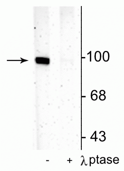 1 - Anti-GluR1-Subunit (Ser831) Antibody AN1416