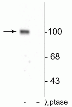 1 - Anti-GluR1-Subunit (Ser845) Antibody AN1417