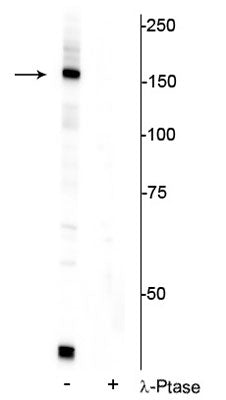 1 - Anti-FANCI (Ser556) Antibody AN1382
