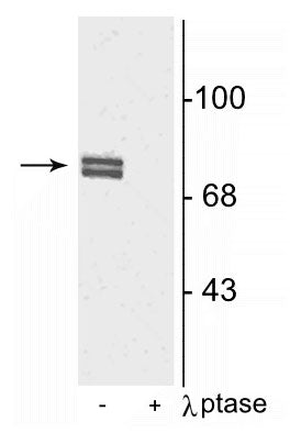 1 - Anti-5-Lipoxygenase (Ser523) Antibody AN1297