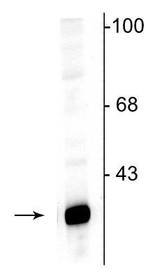 1 - Anti-DARPP-32 Antibody AN1353