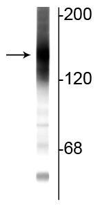 1 - Anti-Adenylate Cyclase III Antibody AN1298