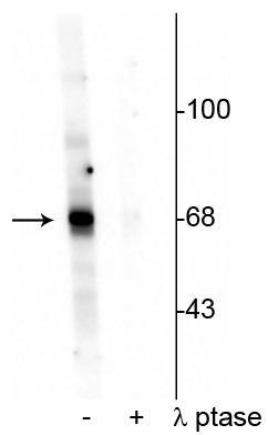 1 - Anti-AKT (Thr342) Antibody AN1307
