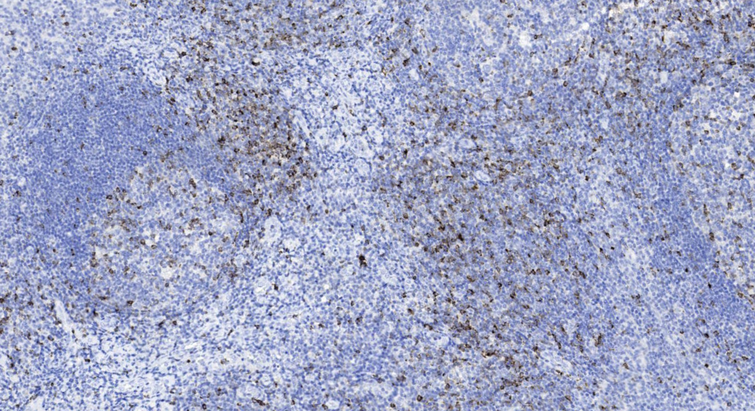 14 - CTLA-4 AD80586