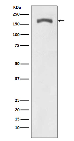 1 - Phospho-PDGF Receptor beta (Y740) Antibody AP90676