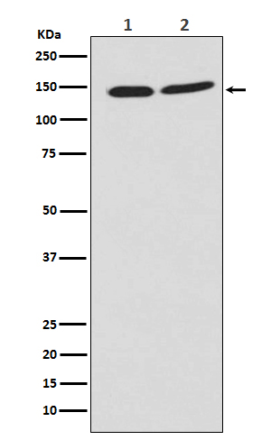 1 - PHF8 Antibody AP91527