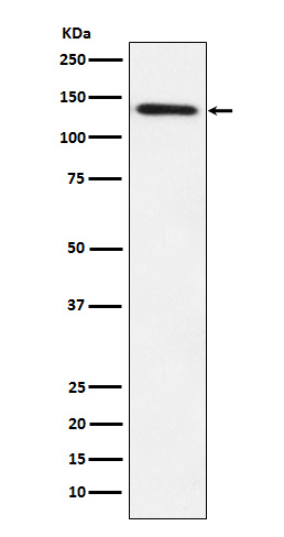 1 - Lipin 1 Antibody AP91868