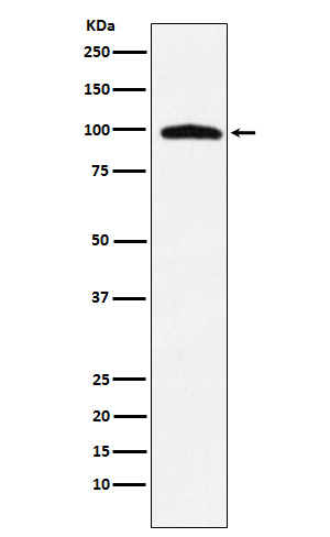 1 - TNPO3 Antibody AP91916