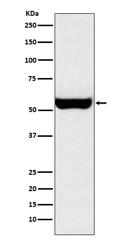 1 - Monoamine Oxidase B Antibody AP91968