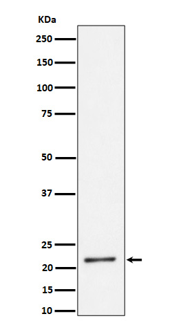 1 - K27-linkage Specific Ubiquitin Antibody AP93184