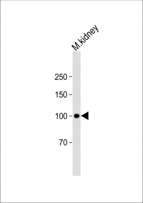 1 - LAMP2 Antibody AM1851b