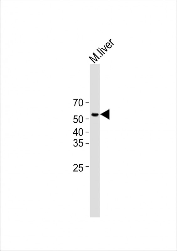 1 - ZCCHC5 Antibody (N-term) AP10044A