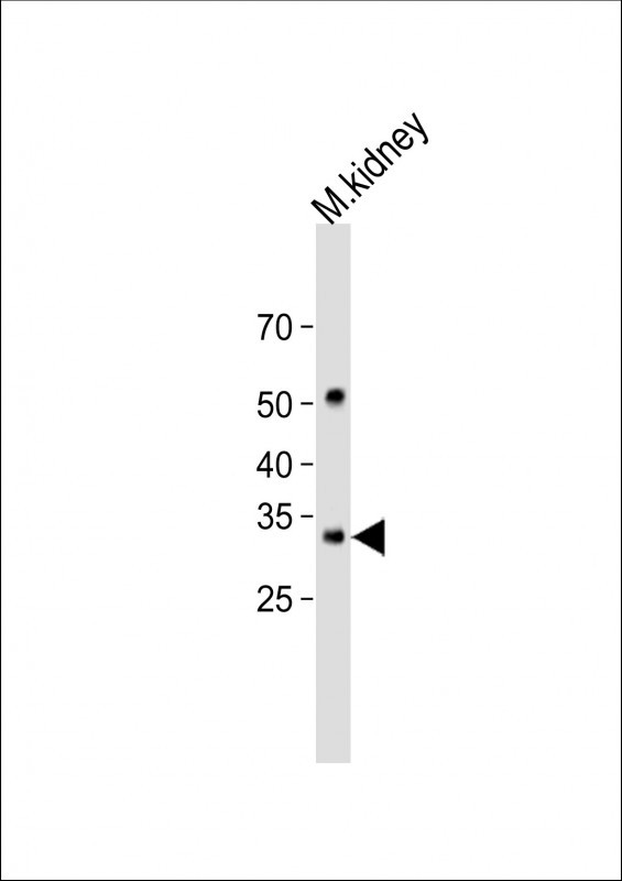 1 - KLF14 Antibody (C-term) AP10279b