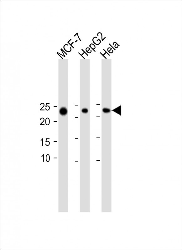 1 - KIAA1644 Antibody (N-term) AP10426a