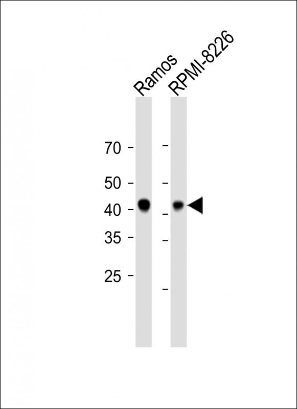 1 - DEGS2 Antibody (C-term) AP10582B