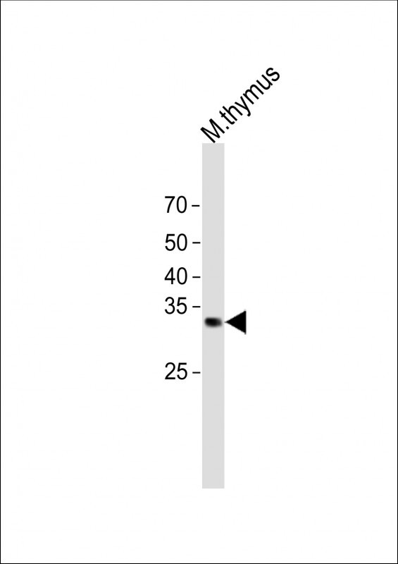 1 - NFKBID Antibody (N-term) AP11893a