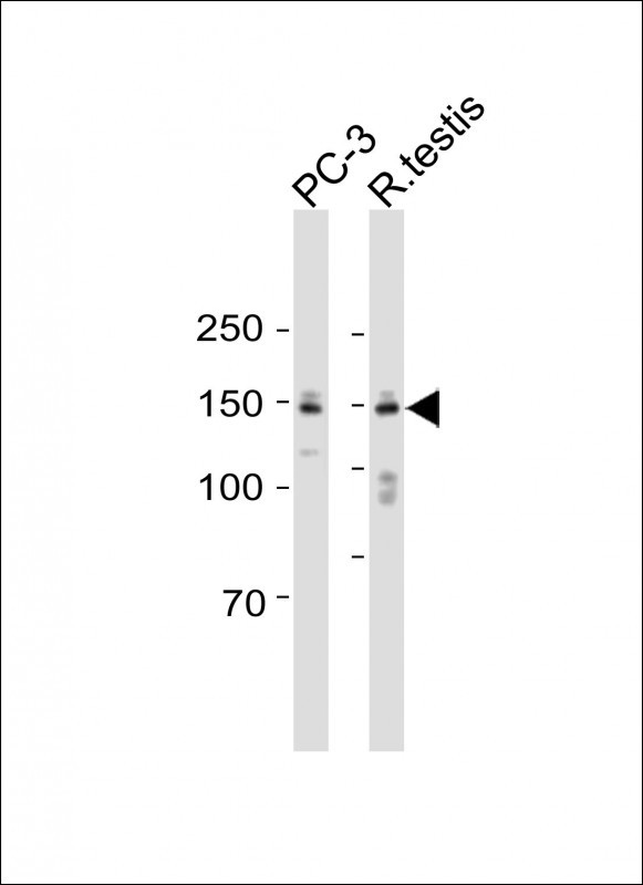 1 - PLEKHA6 Antibody (Center) AP17827C