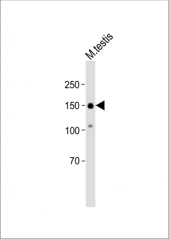 1 - HEPHL1 Antibody (N-term) AP18557a