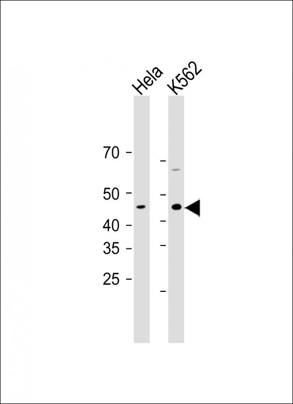 1 - CHPT1 Antibody (N-term) AP10186a