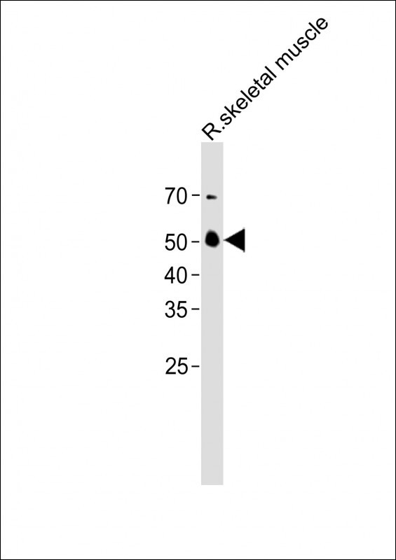1 - ZMYND17 Antibody (C-term) AP11600B