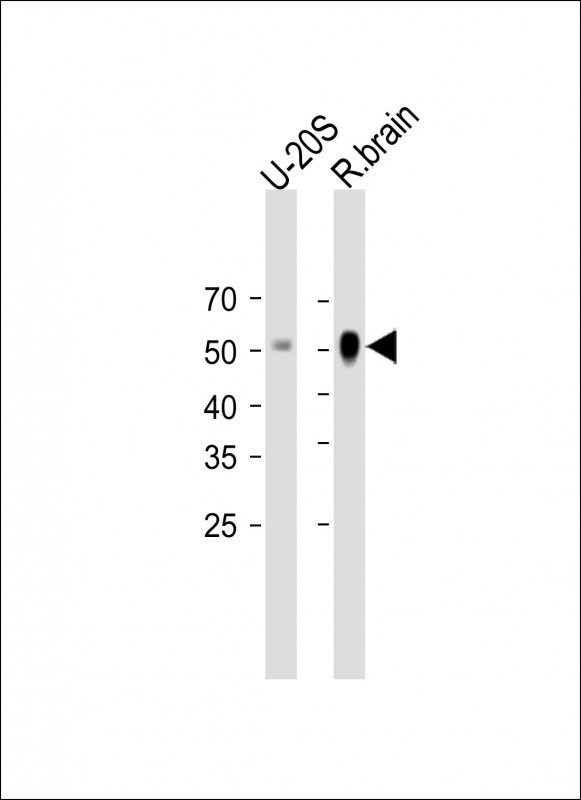 1 - FOXO6 Antibody (Center) AP12340C