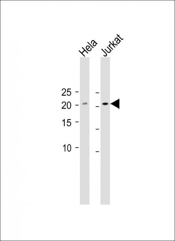 1 - SLMO2 Antibody (Center) AP12404c