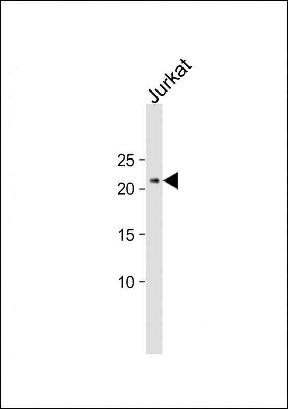1 - SLMO2 Antibody (Center) AP12404c