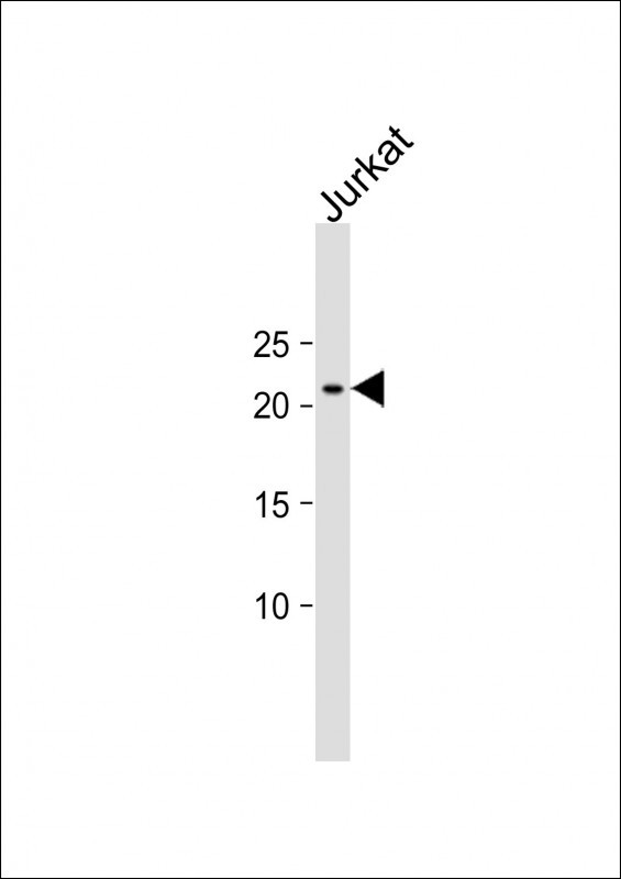 1 - SLMO2 Antibody (Center) AP12404c