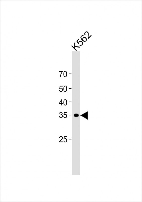 1 - PITX2 Antibody (C-term) AP1429b