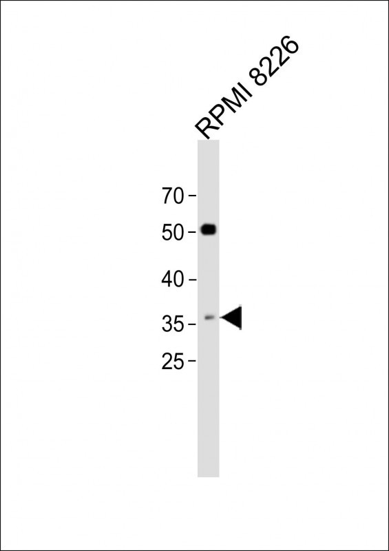 1 - C10orf72 Antibody (Center) AP11192c