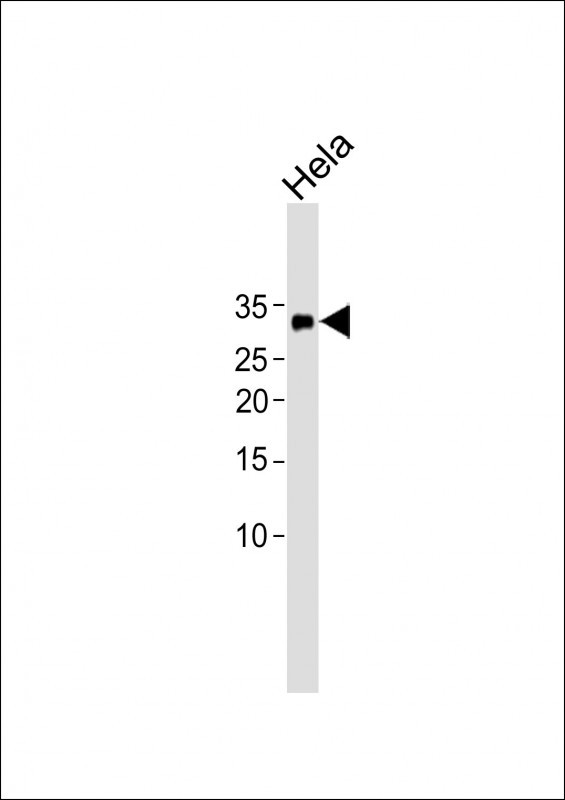 1 - NKX6-2 Antibody (N-term) AP18279a