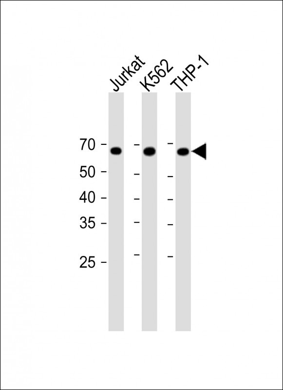 1 - Mouse Tbkbp1 Antibody (C-term) AP20224b