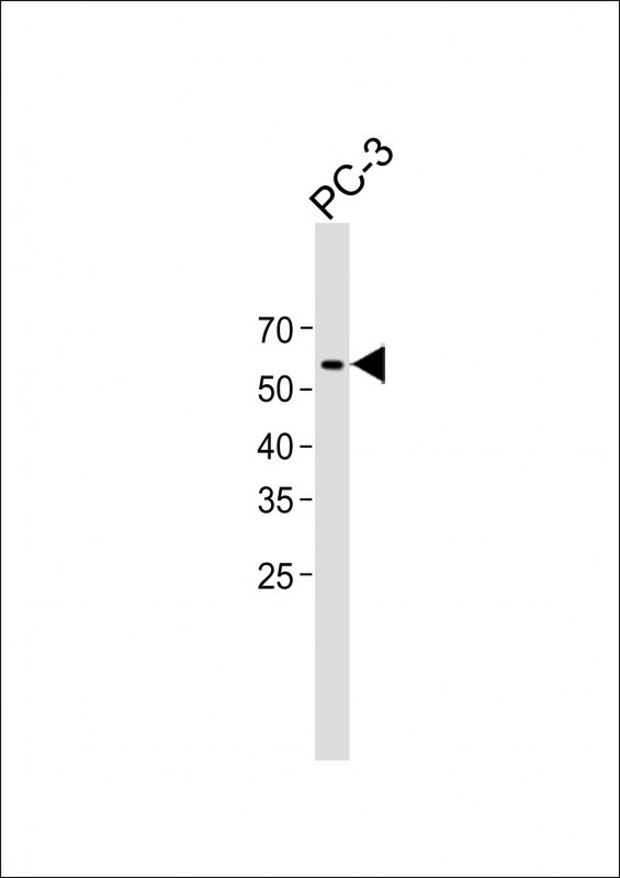 1 - POTEM Antibody (C-term) AP21661b