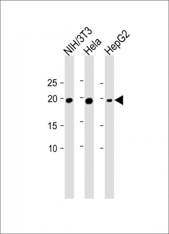 1 - TMED2 Antibody (N-term) AP13140A