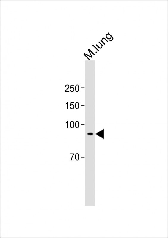 1 - RHBDF2 Antibody (N-term) AP13588A