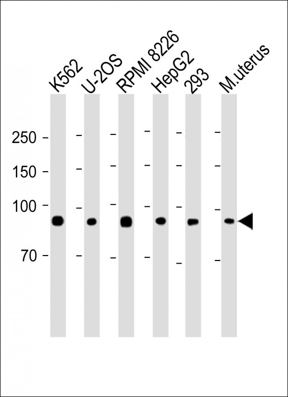 1 - ELFN1 Antibody (C-term) AP18783b