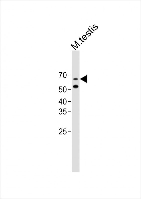 1 - SRRM3 Antibody(Center) AP19628c