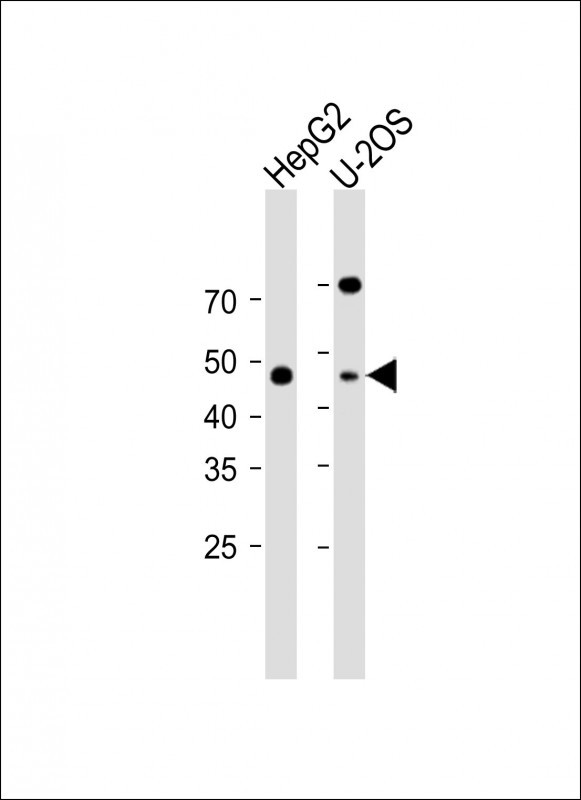 1 - PPIL5 Antibody (Center) AP18105c