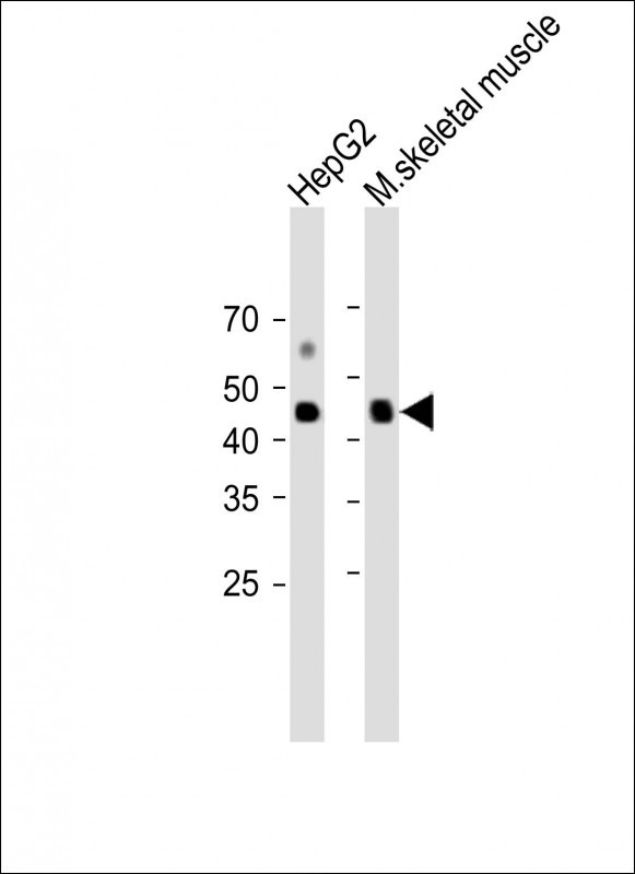 1 - SLC16A10 Antibody (C-term) AP13235B