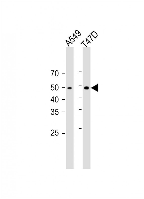 1 - TM6SF1 Antibody (N-term) AP16209a