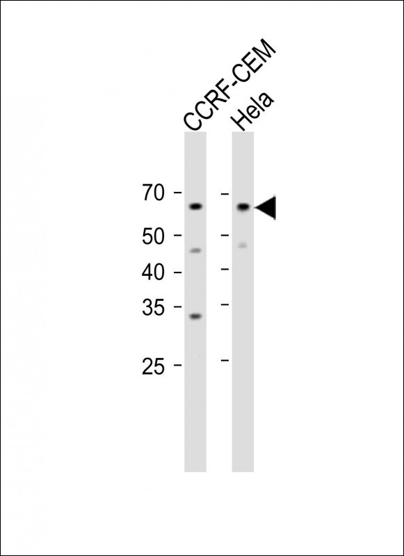 1 - GOLGA8B Antibody (N-term) AP18554a