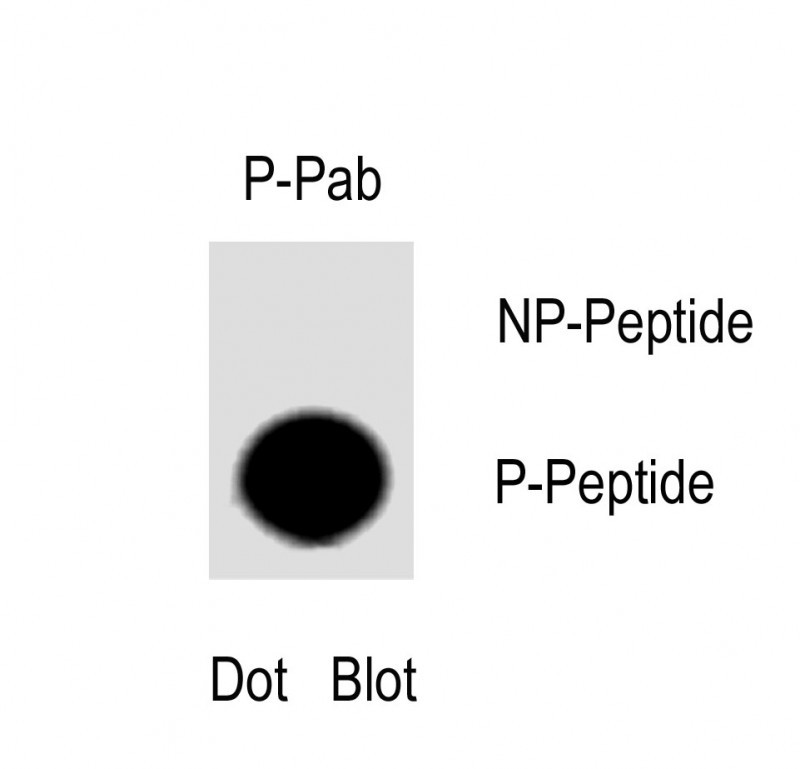 1 - Phospho-Tau (T217) antibody AP3928a