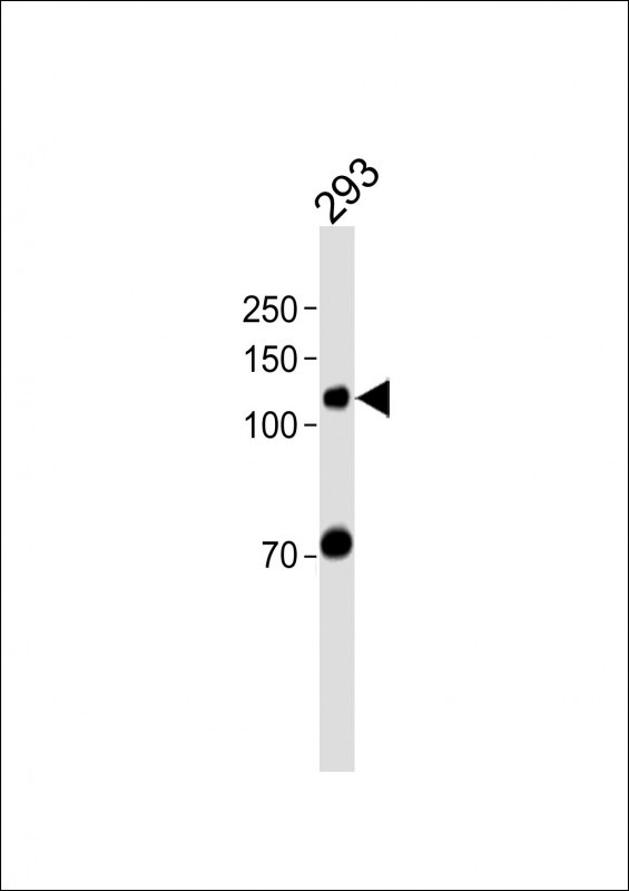 1 - ZNF516 Antibody (Center) AP20170c