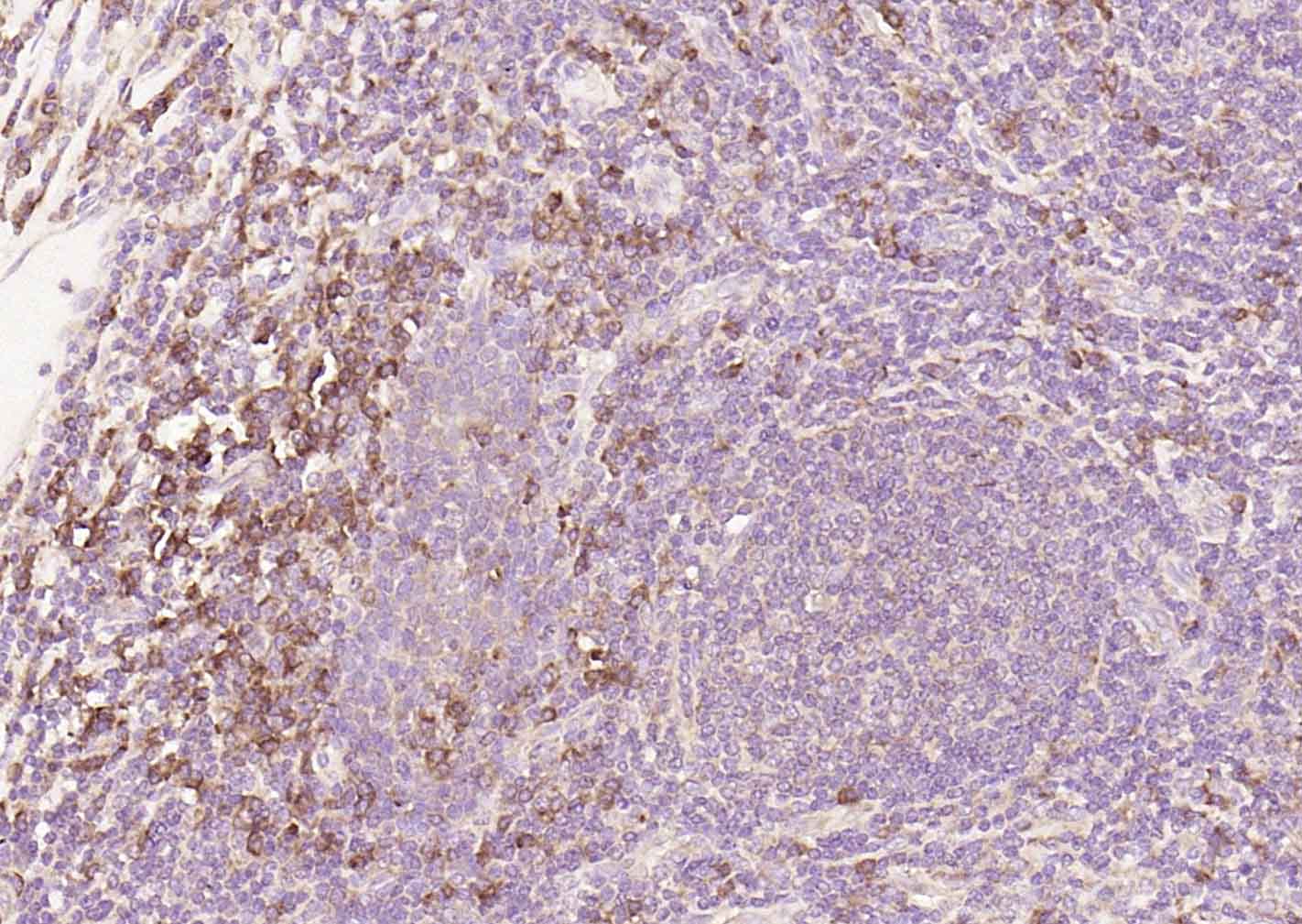 14 - CD25 Recombinant Rabbit mAb AP94312