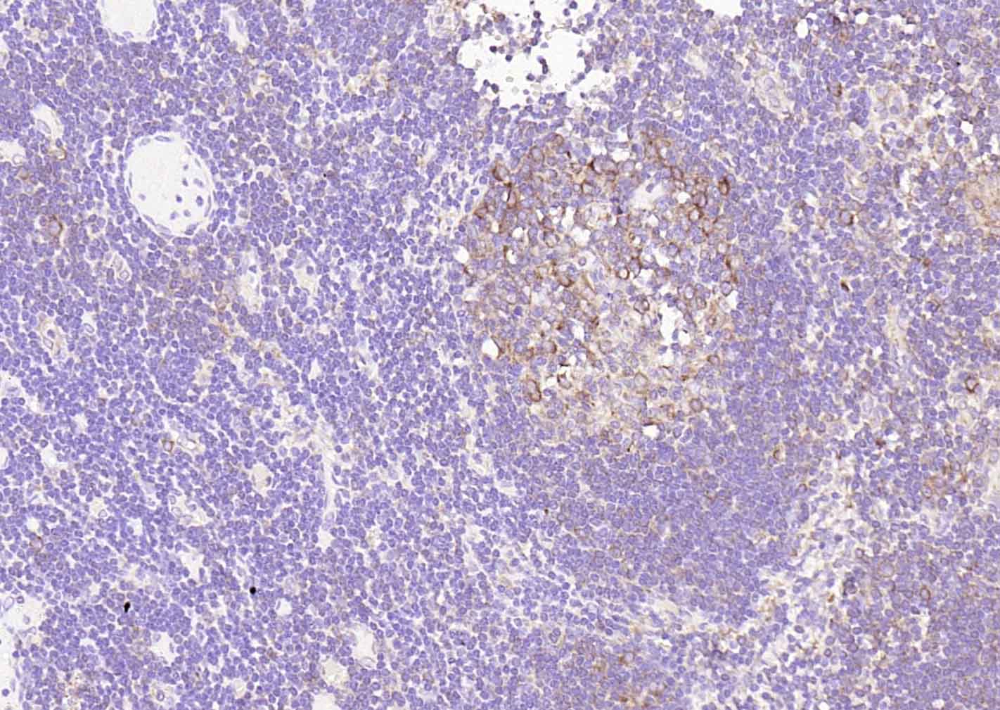 14 - CD25 Recombinant Rabbit mAb AP94312